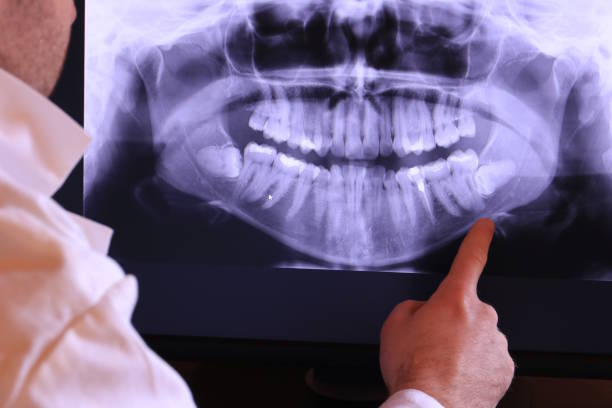 Best Broken or Chipped Tooth Repair in Marin City, CA